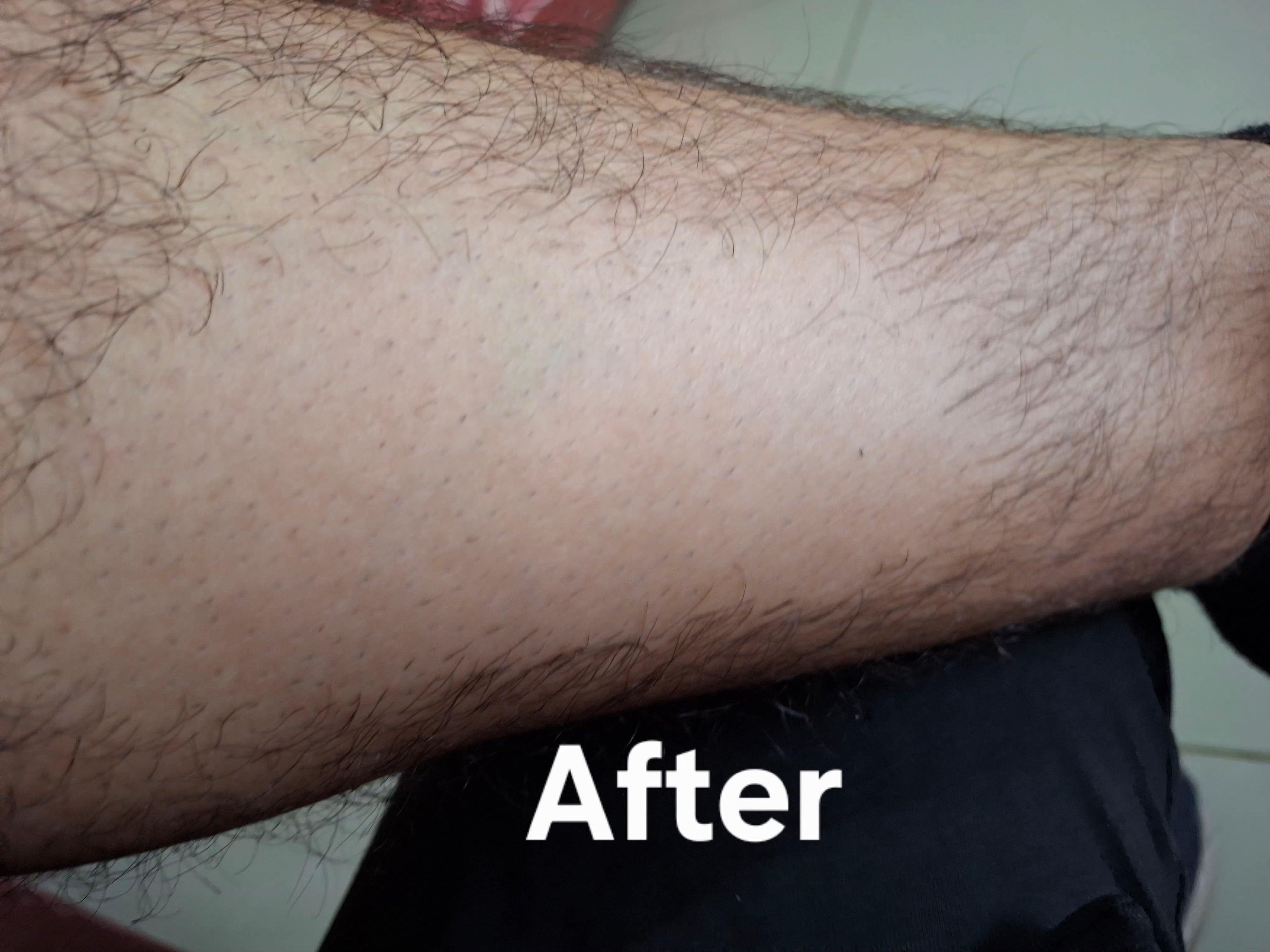 Hair Removal Spray