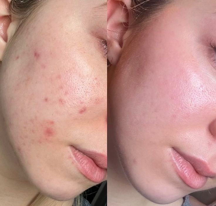 Dr. Althea 345 Relief Cream