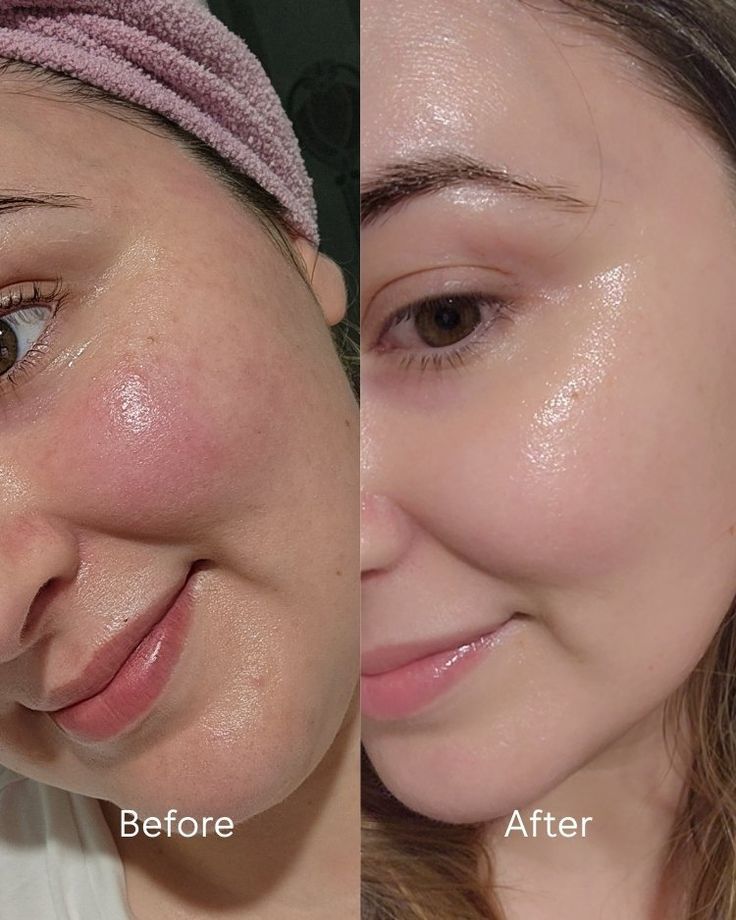 Dr. Althea 345 Relief Cream