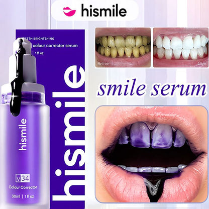 Teeth Whitening