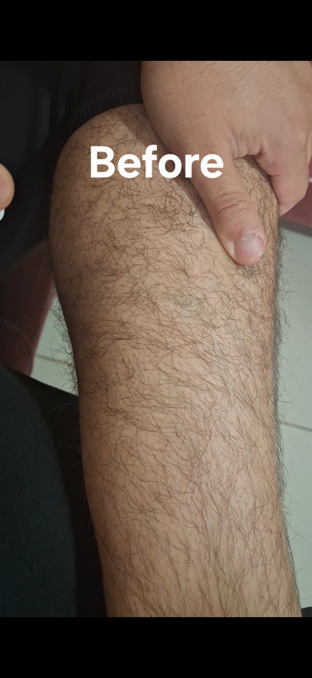Hair Removal Spray