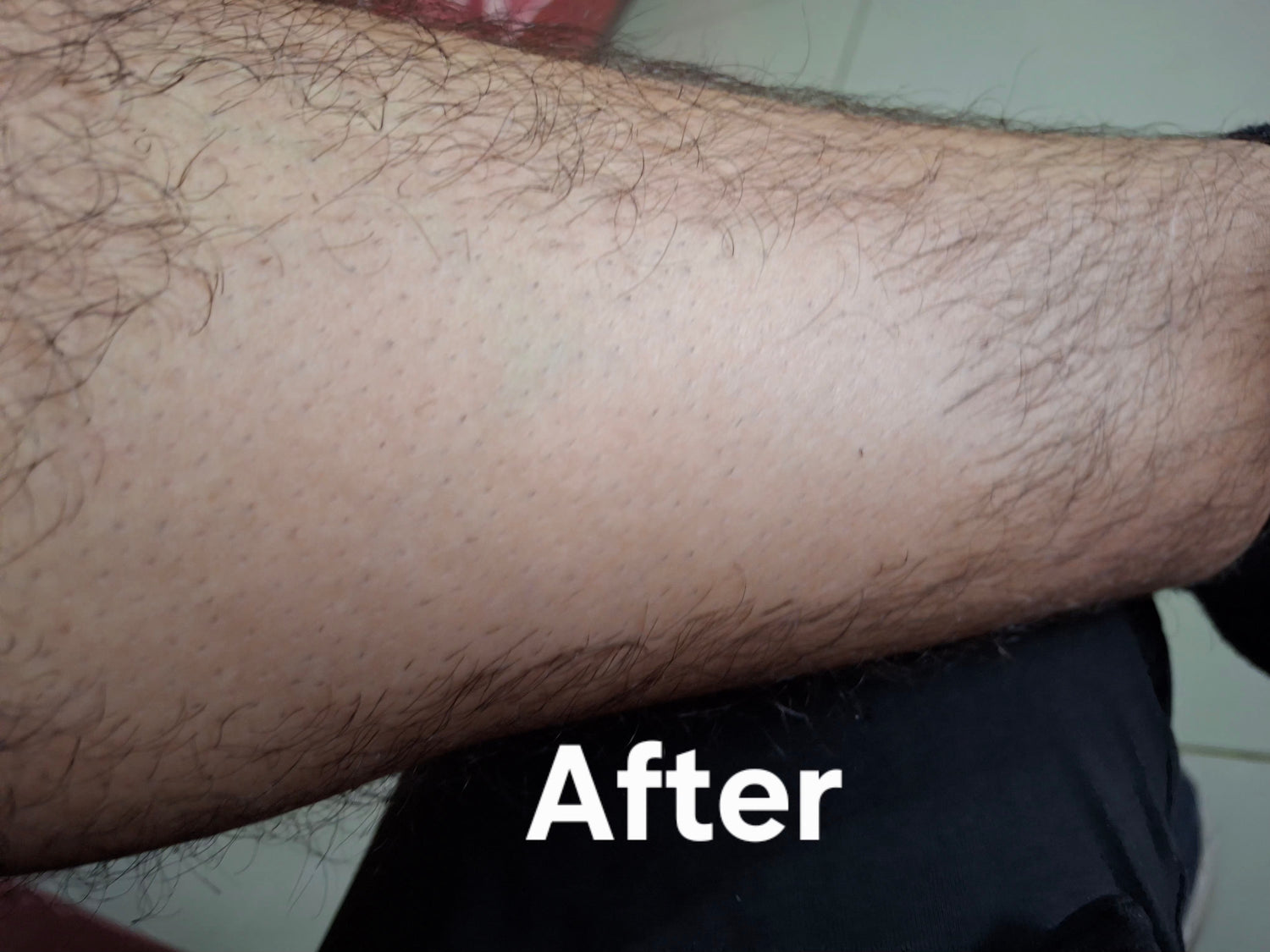 Hair Removal Spray