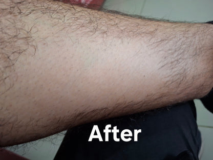 Hair Removal Spray