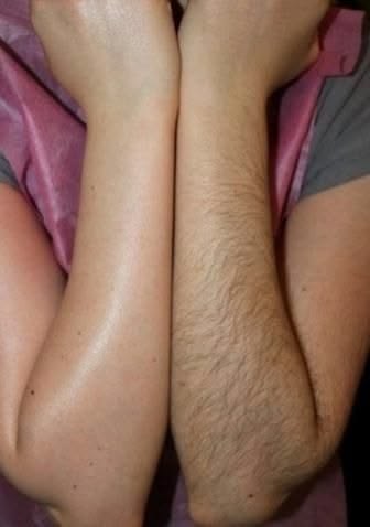 Hair Removal Spray